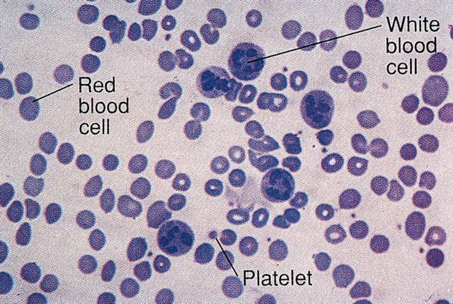 Blood Approximately 5-6 liters in the adult body Composed of: Red Blood Cells Erythrocytes Carry Oxygen on
