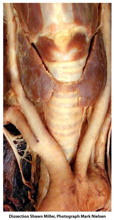 Structure of Thyroid Gland Butterfly-shaped organ - 2 lobes (wings) lobus dexter (Rt.) lobus sinister (Lf.) cone-shaped str.