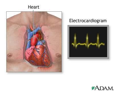 Diagnostic Tests For Heart Disease Electrocardiogram ( EKG ) 1.
