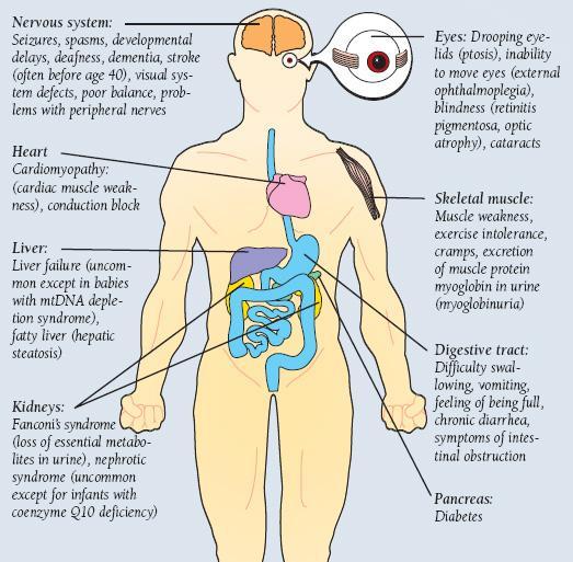 Symptoms of Respiratory Chain Disorders Exercise Intolerance Cardiomyopathy Neurological Symptoms