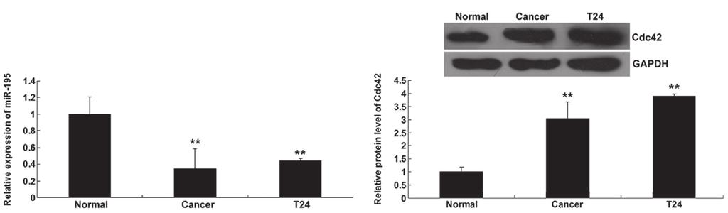 tissues (normal), as well as in bladder cancer T24 cells. ** P<0.01 vs. normal.