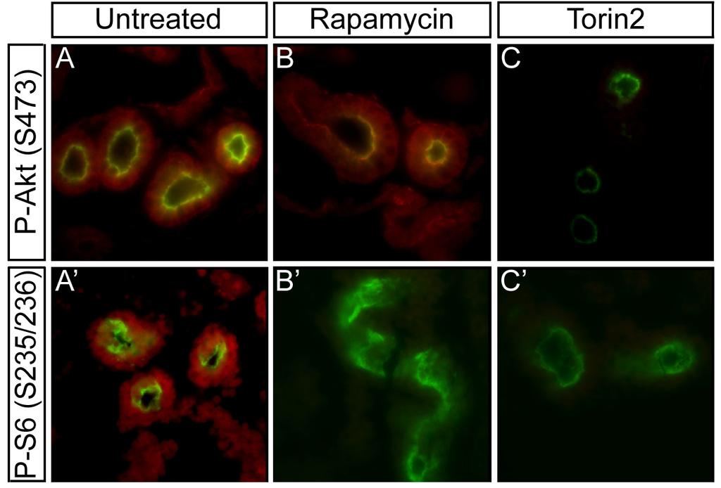 Figure 6. Rapamycin Inhibits mtorc1 and Torin2 Inhibits mtorc1 and mtorc2. Immunohistochemistry on slides with antibodies directed against Phospho-Akt (mtorc2) and Phospho-S6 (mtorc1) were used.