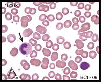 Learning Outcomes Upon completion of this exercise, participants will be able to: identify the morphologic characteristics of normal peripheral blood leukocytes.