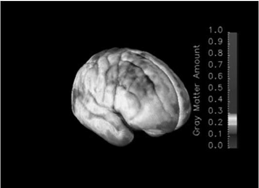 Cortical Gray Matter Ages 4 to 25 years Prefrontal Cortex