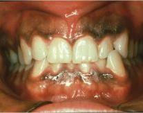 8. Dental Conditions Besides malignant and