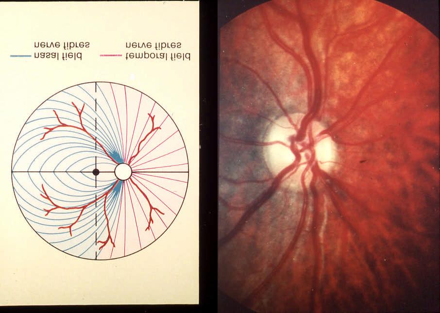Topographical arrangement of retinal nerve