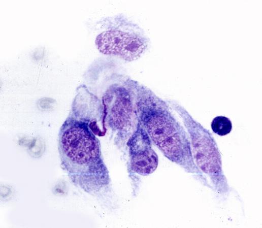 Even though the cytological appearance may be identical in either species, in the cat, the tumor may be more aggressive and become systemic with associated metastasis and monoclonal gammopathies.