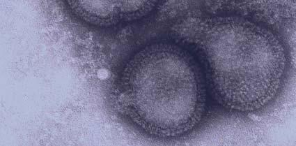H3N2, A H1N1 A/New Caledonia/20/99 (H1N1)