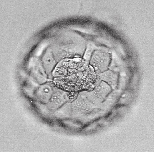 Example of a 4AA blastocyst.