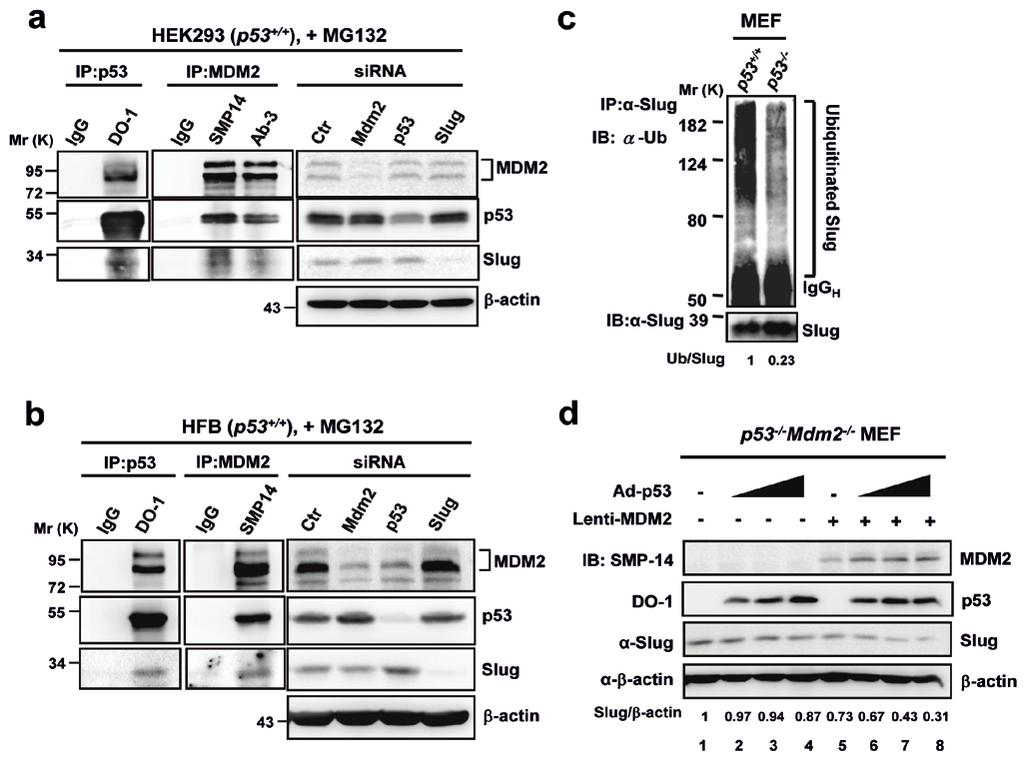 Figure S2 (a, b) Interactions of endogenous p53, MDM2, and Slug in HEK293 and HFB cells. Cells were treated with 10 µm MG132.