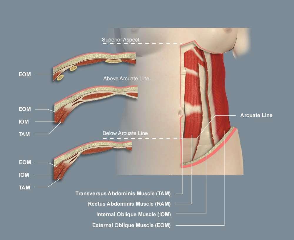 The rectus sheath Arcuate line: is the lower border of the posterior aponeurotic part of the rectus sheath.