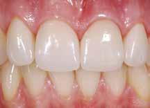 meet your patients demand for naturally white teeth. Interesting!