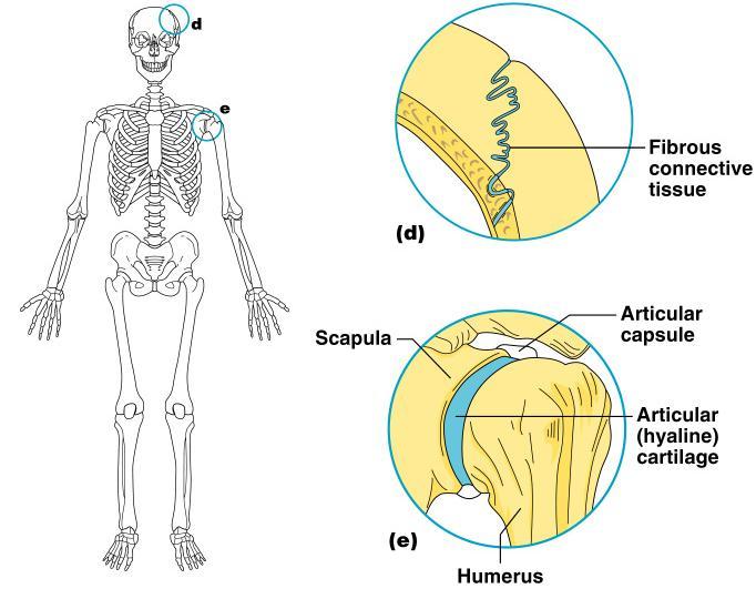 Fibrous Joints Bones united by fibrous tissue Examples Sutures