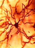 Neuron located in the cerebral