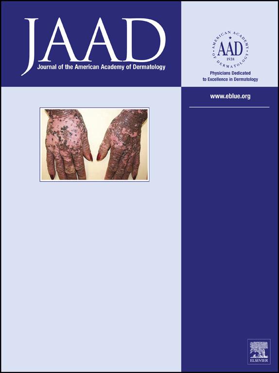 Accepted Manuscript Wound Management Strategies in Stevens-Johnson syndrome/toxic Epidermal Necrolysis: An unmet need Lee Haur Yueh, MBBS, MRCP, MMed, FAMS PII: S0190-9622(18)32138-8 DOI: 10.1016/j.
