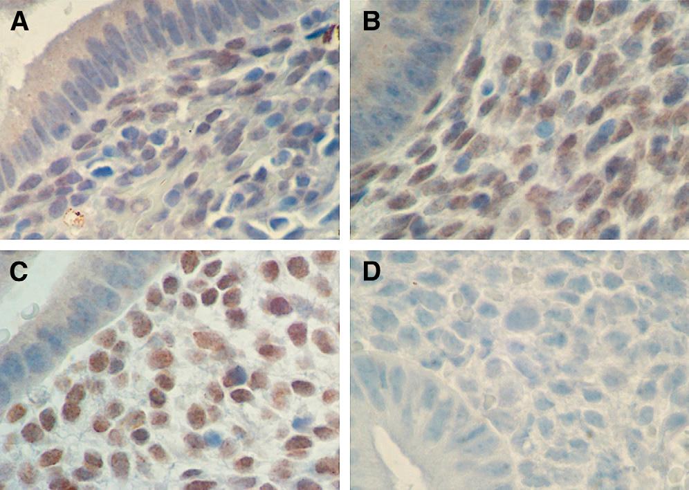 FIGURE 2 Endometrial HOXA10 immunohistochemistry. Immunohistochemistry identified HOXA10 protein expression in endometrial glands and stroma.