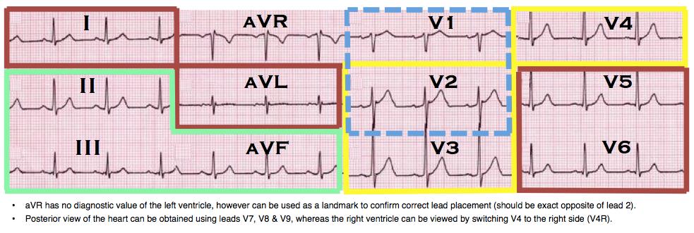 12 LEAD ECG LAYOUT: 12 LEAD ECG PRE-ANALYSIS: Tracing: Should be clear with minimal artefact, and at least one P-QRS-T complex visible in each lead.