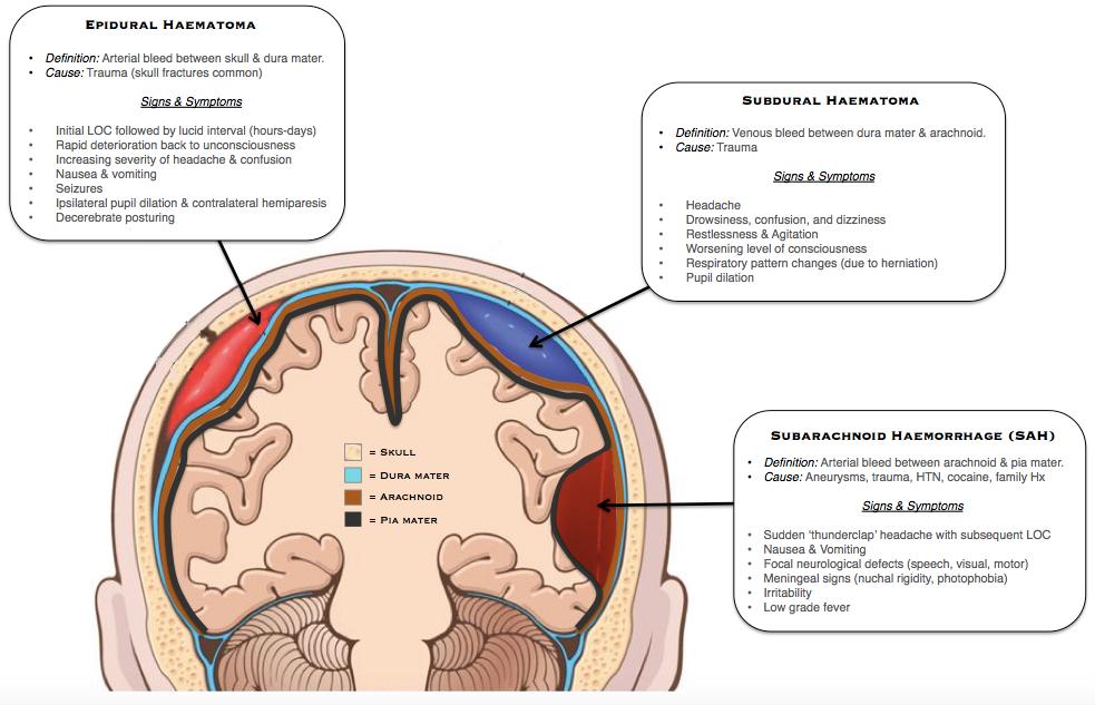 There are 5 primary headache syndromes: CEREBRAL