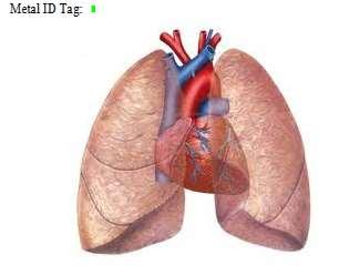 CAR05 - Heart/Lung Block TISR.JA.041 LAB 1.1. Follow TISR.JA.042 