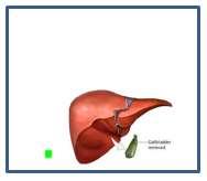 Transect any other blood vessels and tissues attaching liver and gallbladder to the body LAB 1.5.