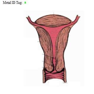 REP01 - Uterus TISR.JA.084 LAB 1.1. Make incision from bottom of xiphoid process to 1 inch superior to pubis using scalpel LAB 1.2.