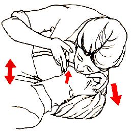 Rescue Breathing Instructions 4 Pinch the person s nose closed. 5 Cover the person s mouth with your mouth.