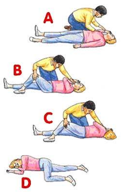 Recovery Position Face and body turned to one side Hand supports head Bent knee supports body If You Administer
