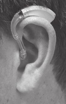 While holding the hearing aid in place, insert the power dome or ear mold into your ear canal. 2.
