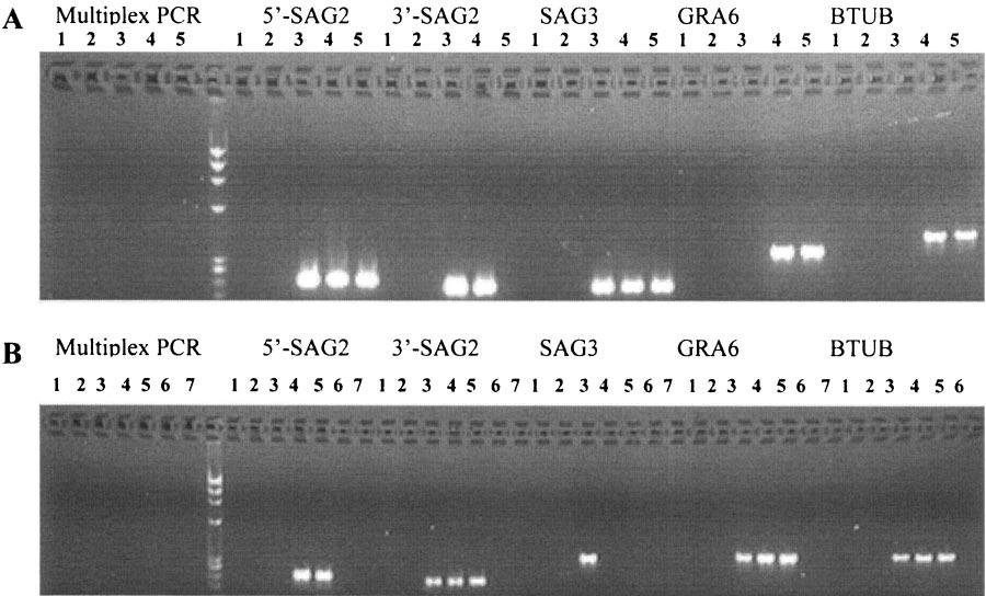 VOL. 44, 2006 GENOTYPING T. GONDII 1385 FIG. 1. Sensitivity of multiplex PCR analysis of T. gondii in AF (A) and CSF (B) samples.