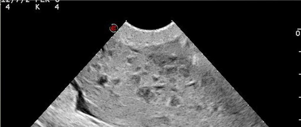 Ultrasonography Abdomen Cardiac neoplasia