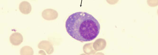 B Lymphocytes B lymphocytes develop from precursors in the bone marrow.