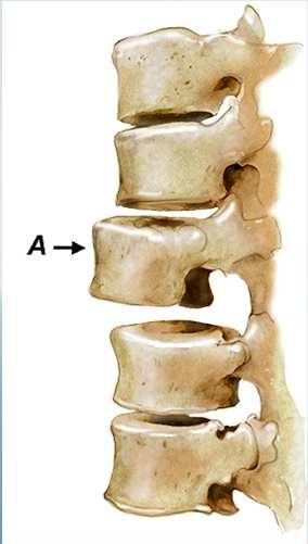 Other Common Mechanisms of Cervical Injury Spondylolisthesis Other