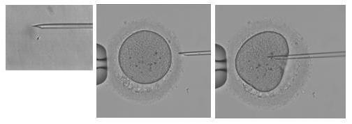 Methods of in vitro fertilisation At present, two methods are used to fertilise oocytes in vitro.