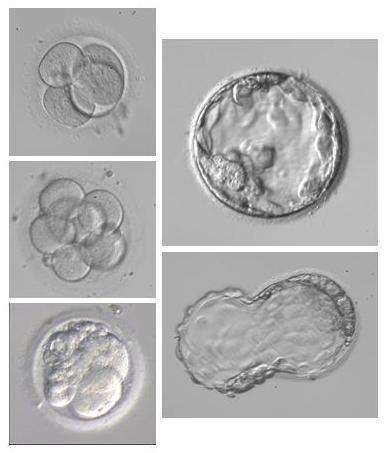 Embryo culture and development, embryo transfer After insemination or microinjection, the oocytes are cultured in petri dishes, either in an open system in approximately 0.