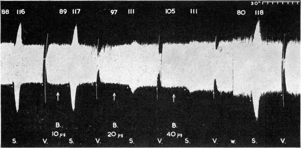 118 S. HUKOVIC If I v I FIG. 1.-Isolated rabbit atria with sympathetic and vagus nerves. S, sympathetic stimulation, showing increase in rate (beats/min.; figures above the tracing) and amplitude.