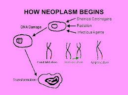 MALIGNANT NEOPLASMS Malignant neoplasms Acute lymphocytic leukemia Acute myelogenous