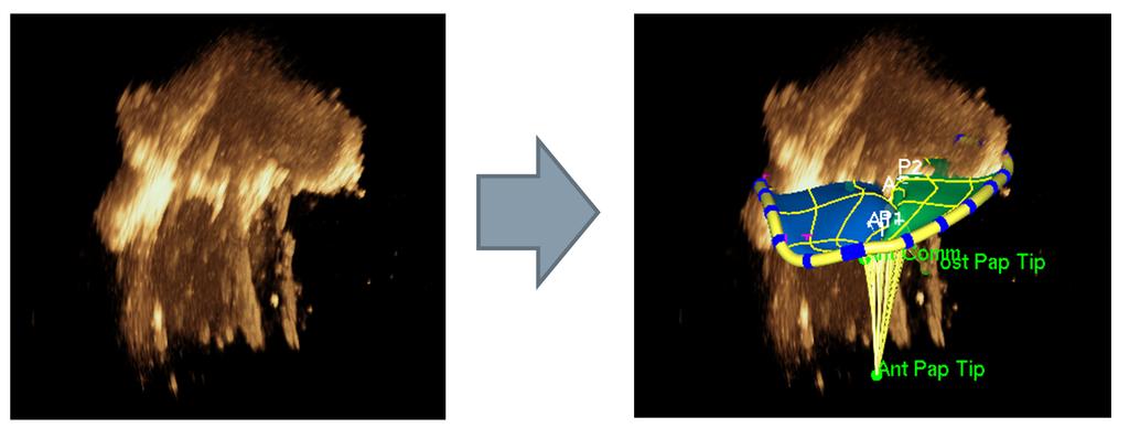 Multi-modal Validation Framework of Mitral Valve Computational Models 5 Fig. 3. Left: Echo scan of mitral valve (MV) within the in-vitro setting, right: extracted geometric model of the MV.