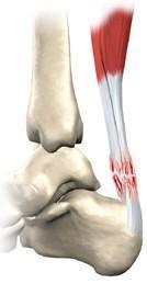 Achilles Tendon Rupture In case-controlled study of Surgical repair Significant improvement in the PRP adjunctive group for