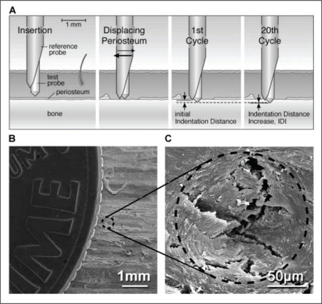 Pawlowska and Bilezikian Page 14 Fig. 2. Indentation procedure for measuring material properties of bone in vivo and SEM imaging of an indent on a human bone sample.