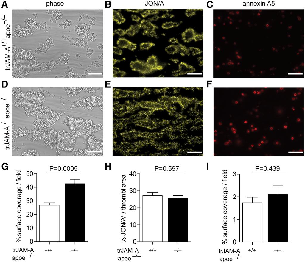 Karshovska et al Elevated Atherosclerosis in Platelet-JAM-A KO-Mice 591 Figure 2. Platelet aggregation on collagen under flow conditions.