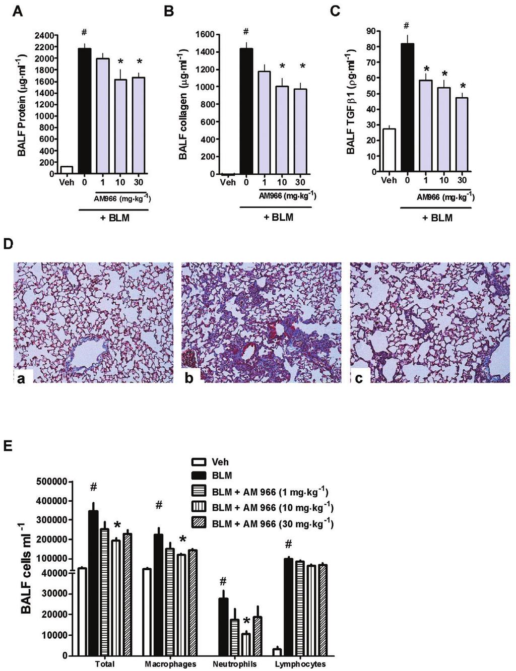 1706 JS Swaney et al Figure 5 AM966 reduces vascular leakage and fibrosis in a 7 day bleomycin model. Mice were given intratracheal bleomycin sulfate (BLM; 3.0 units kg -1 ) or saline vehicle (Veh.