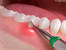 How can gum disease be treated?