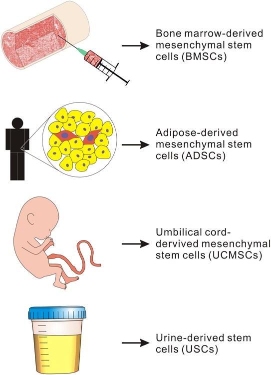 Stem cells in bone regeneration BMSCs Promising when seeded on Tricalcium-phosphate scaffold limited supply, donor site morbidity ADSCs Easier to harvest, easily