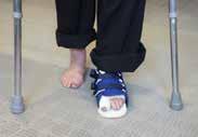 Will I be able to walk? When you return from theatre you will have a large dressing and bandage around your big toe, foot and ankle.