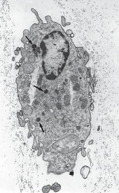 In the cytoplasm there are mitochondria (M), dense granules (arrows), vacuoles (V), and microvilli (Mi) (1670). Courtesy of JL Craft and DM Albert, Harvard Medical School, Boston.