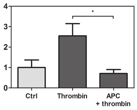 The protective effect of ctivated Protein C (PC) on endothelial barrier function assessed by solute permeability assays and RTC platform. Confluent E.