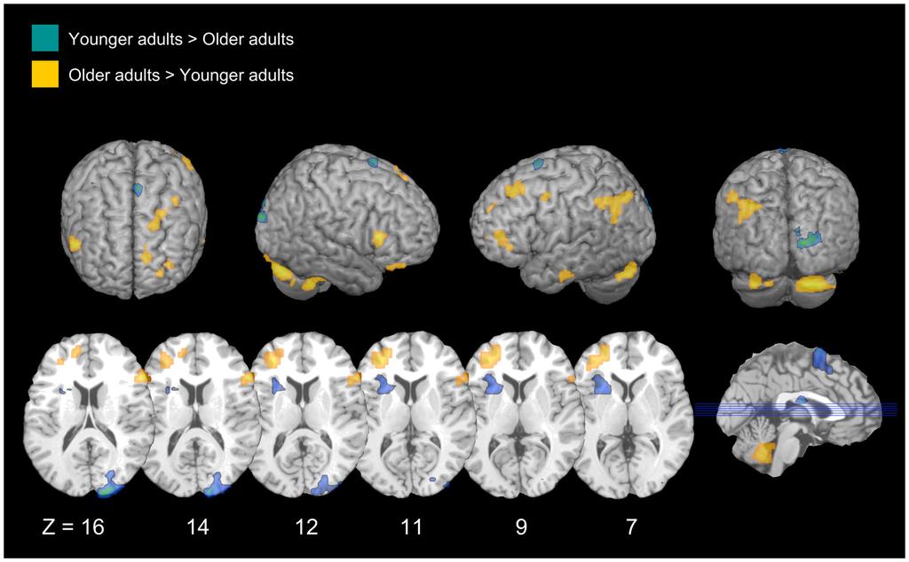 Figure 2. Age differences in successful intentional remembering.