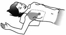Flat position: Lie flat on your back with a pillow or folded towel under the shoulder of the breast to be examined.