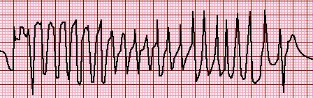 TdP: Definition Polymorphic VT with