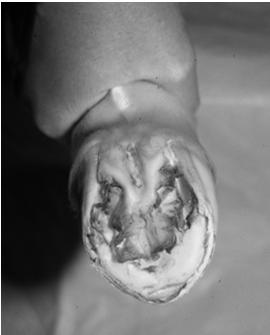 3) Examine the Foot Is the hoof worn more on one side?